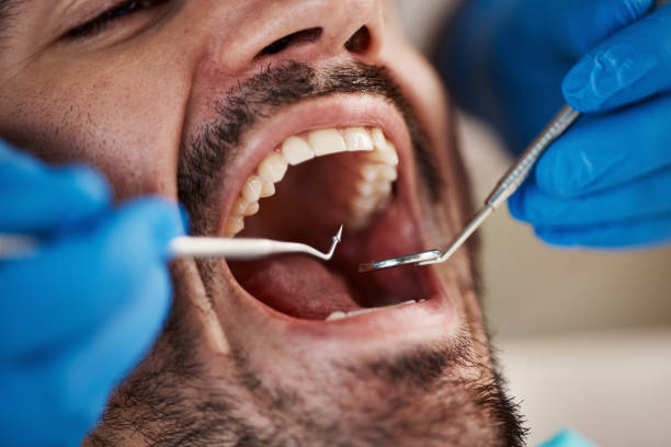 Dentist for Dental Trauma in CT