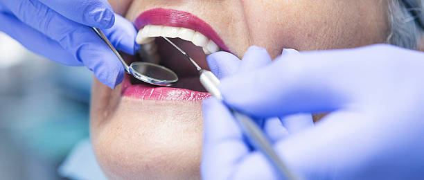 Best Knocked-Out Tooth Emergency  in Coleytown, CT