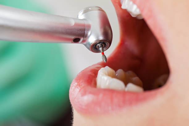 Best Dentist for Severe Toothache  in Coleytown, CT
